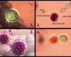 A Step Toward Diabetes Immunotherapy