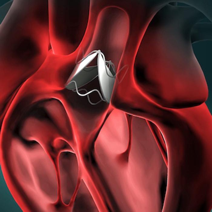 illustration of prototype of heart valve in a heart