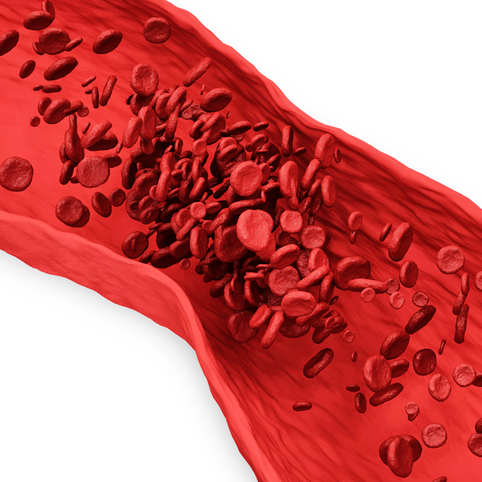 illustration of inside of a blood vessel with red blood cells clotting