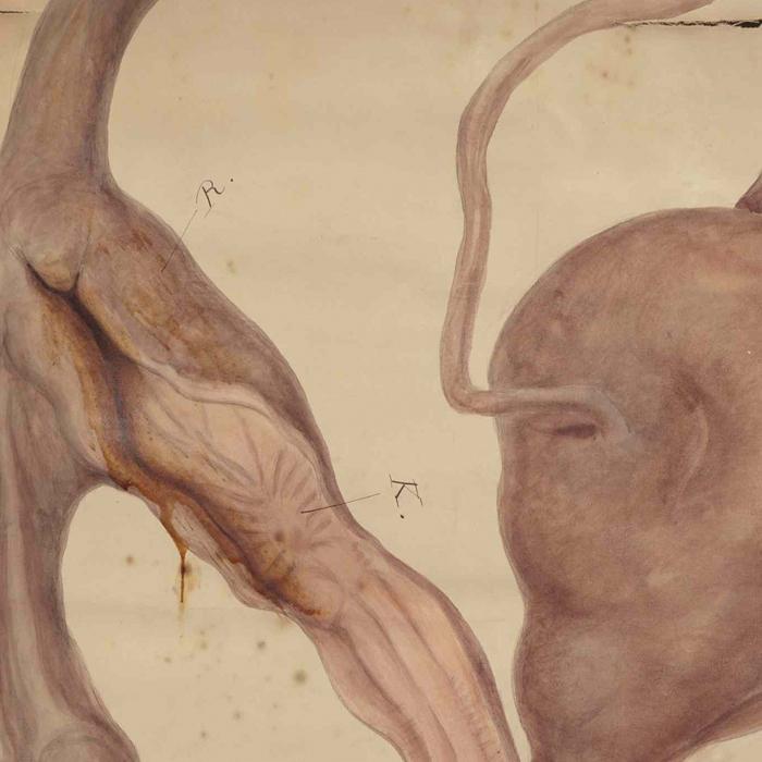 detail from an illustration of the urogenital system of an intersex patient, circa 1800