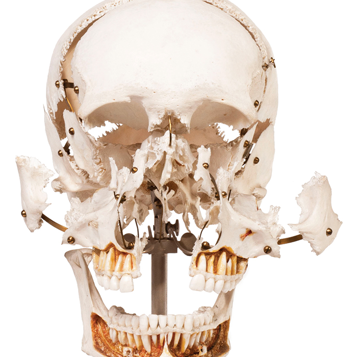Skull expanded model