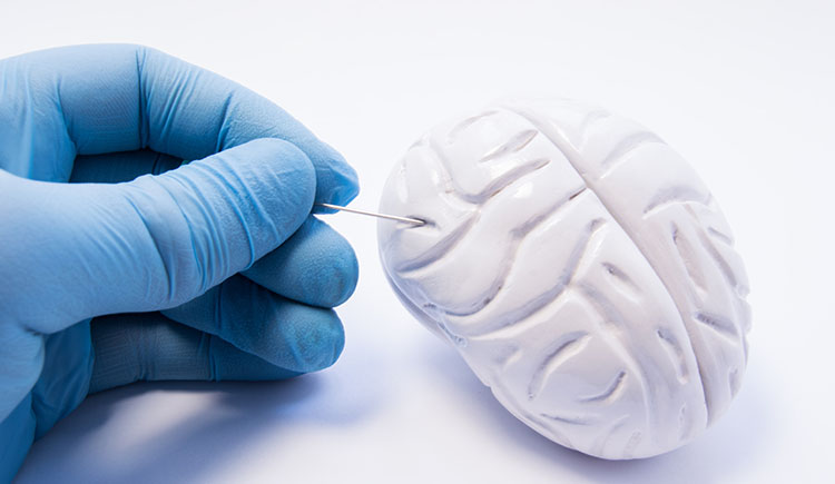 AI tool decodes brain tumor genome during surgery