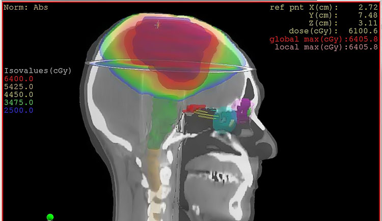 Brain Circuits and Addiction | Harvard Medical School