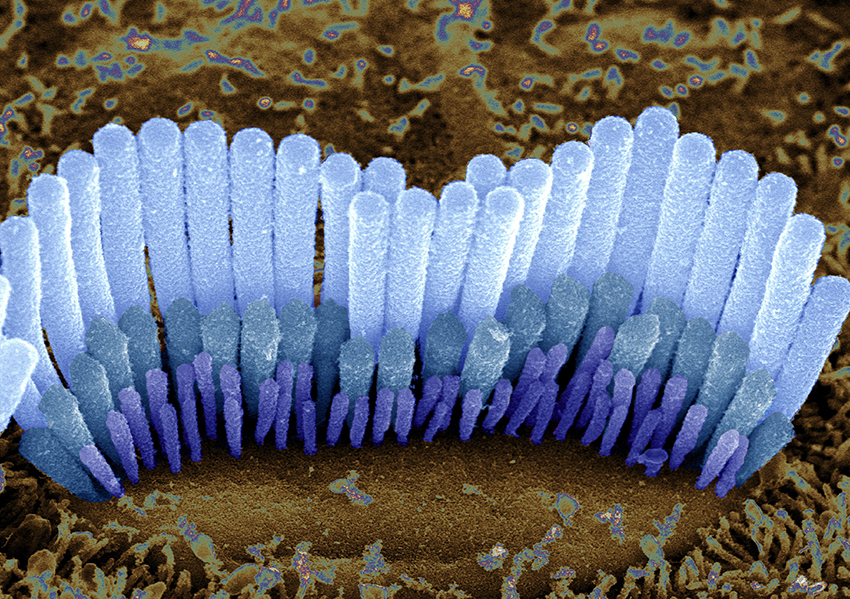 hair cells