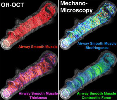 Two kinds of imaging—optical coherence tomorgraphy and mechano-microscopy—reveal airway volume and thickness during an asthma attack (left) and an estimation of the force with which the airway muscle contracts. Image: Mass General