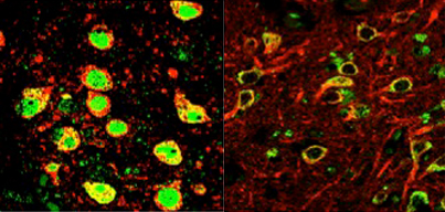 Side by side microscopy images with REST protein in fluorescent green