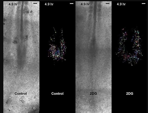 Make Room for Metabolism