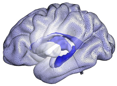 A computational model of brain structures that form the basis of BrainPrint, a system for representing the whole brain based on the shape, rather than the size, of structures. Image: Martin Reuter and Christian Wachinger/Martinos Center for Biomedical Imaging, Mass General