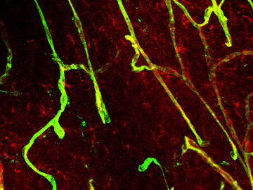Image of blood brain barrier 