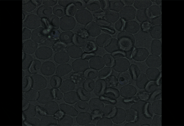 parasites suck it up