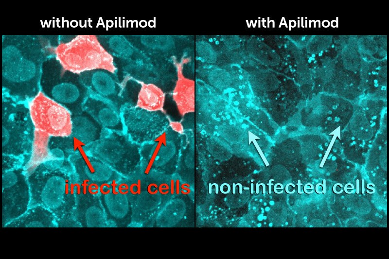 Side by side microscope comparisons of cells with and without SARS-CoV-2 penetration, indicated by pink stain on teal cells