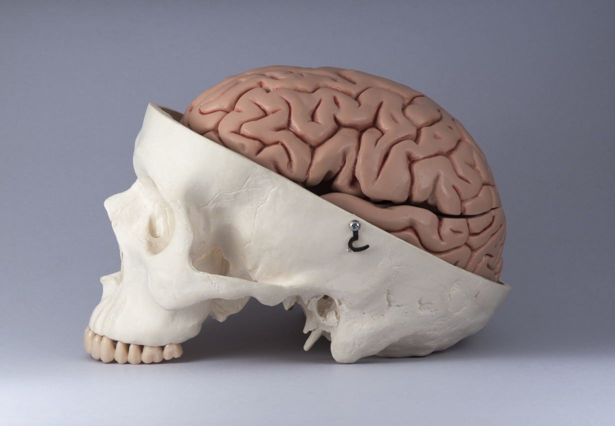 Skull Surprise | Harvard Medical School