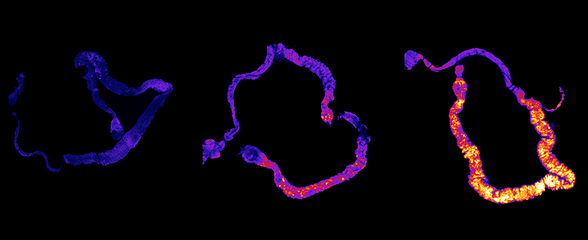 ros accumulation