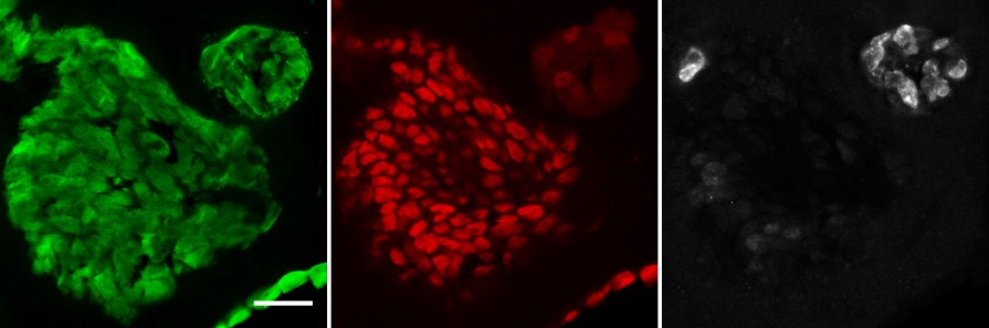 Three squares side by side with a large and a small cell under microscopy: one in green, one in red and one in white