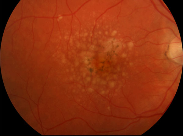 Picking Up the Signals