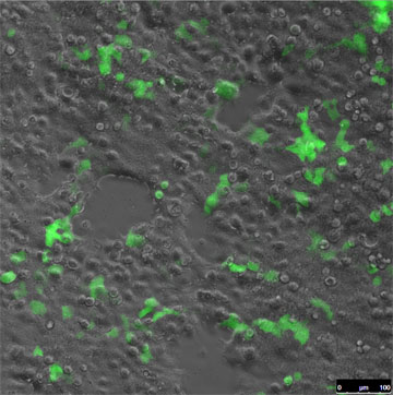 A Sharper Tool for Genome Engineering