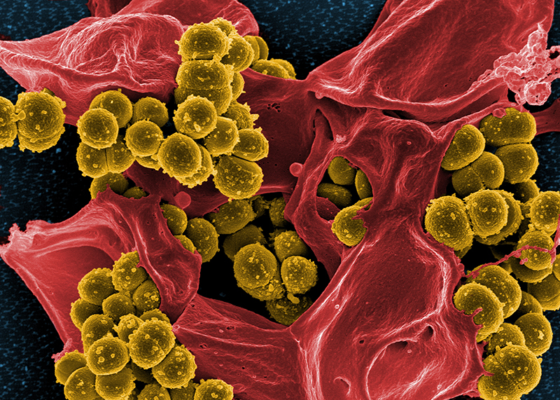 mrsa bacteria