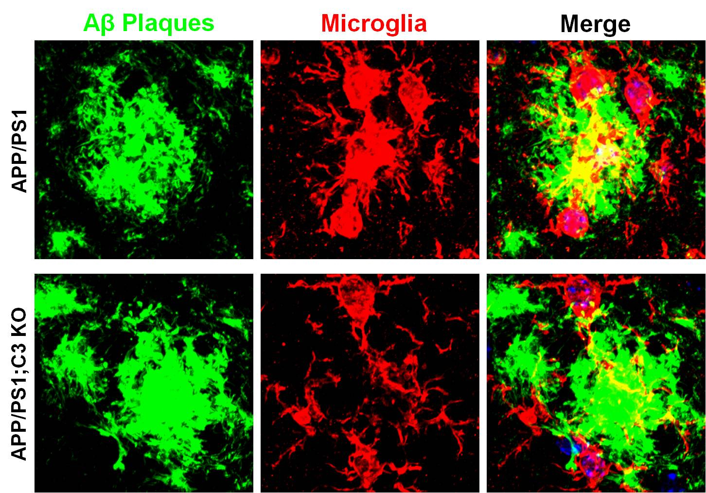 Alzheimer’s-Immunity Link