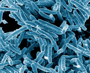 tuberculosis bacteria disease