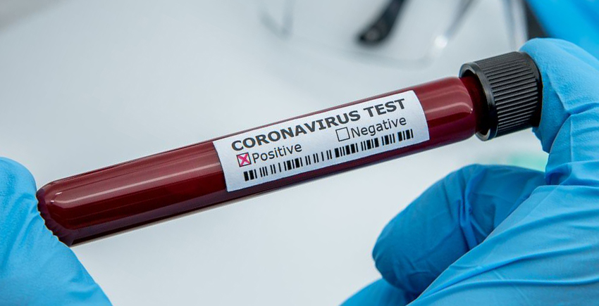 Photo of a vial of blood with a label that says "Coronavirus test" and the "Positive" box checked off