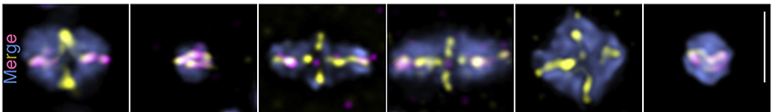 Six boxes show fluorescently dyed chromosomes aligned or misaligned during meiosis